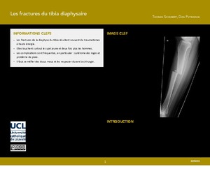 "Les fractures du tibia diaphysaire" icon