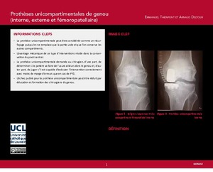 "OER-UCLouvain: Prothèses unicompartimentales de genou (interne, externe et fémoropatellaire)" icon