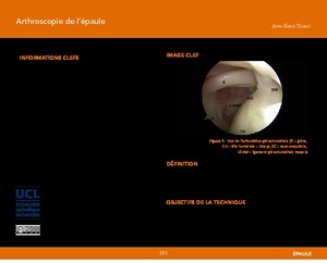 "Arthroscopie de l'épaule" icon
