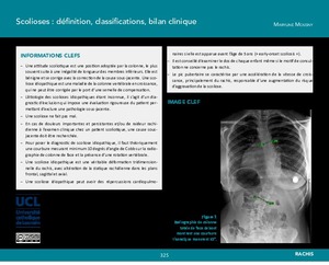 "Scolioses : définition, classifications, bilan clinique" icon