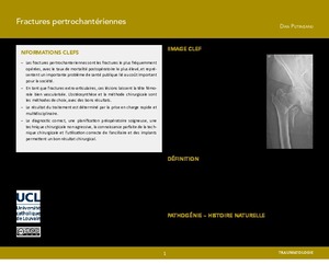 "Fractures pertrochantériennes" icon
