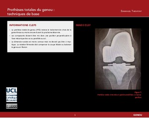 "Prothèses totales du genou : techniques de base" icon