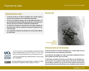 "Fractures du talus" icon