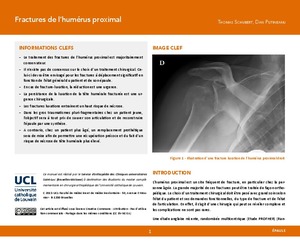 "Fractures de l’humérus proximal" icon