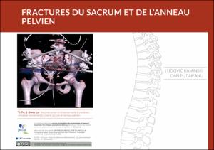 OER-UCLouvain: Les fractures du sacrum et de l'anneau pelvien